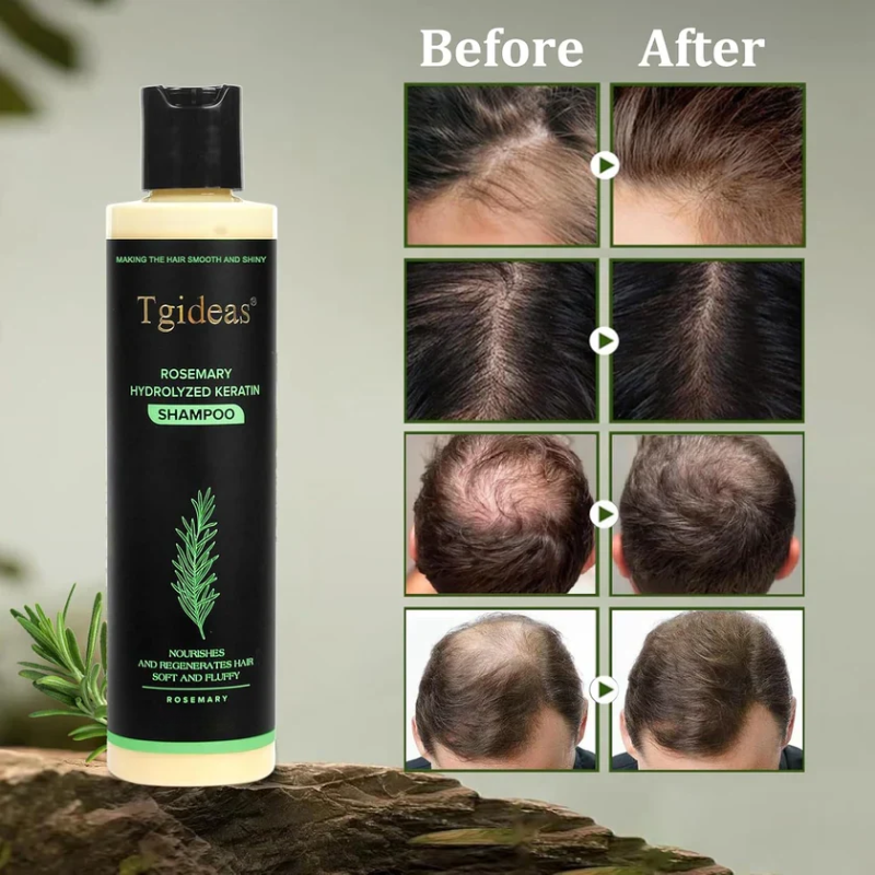 Tgideas® Rosemary Shampoo | Hair Growth & Scalp Treatment